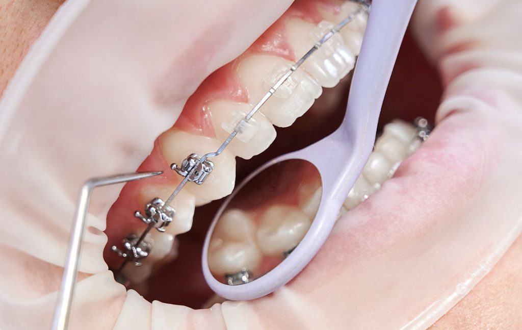 seguro dental Adeslas